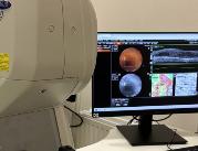 Bytom: Szpital zakupił nowoczesny tomograf OCT