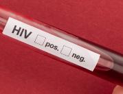 Świadomość na temat HIV wciąż zbyt niska
