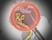 WHO: na ebolę zmarło już ponad 4900 osób; ponad 10...