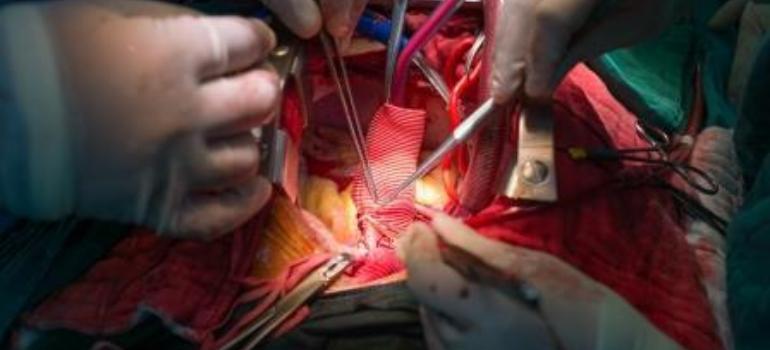 EVAR w leczeniu tętniaków aorty brzusznej – dla każdego?